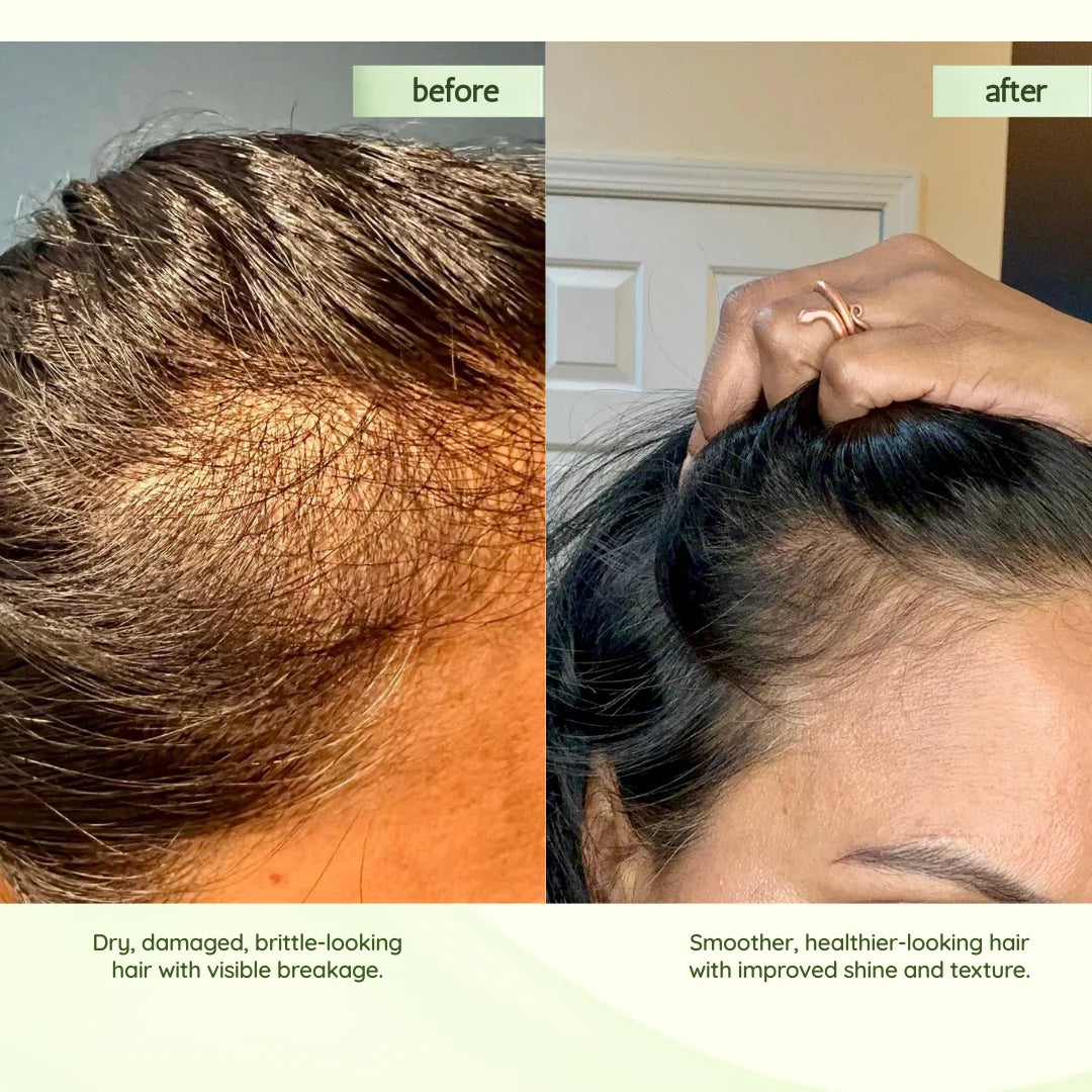 Ayurvedic Scalp & Hair Oil