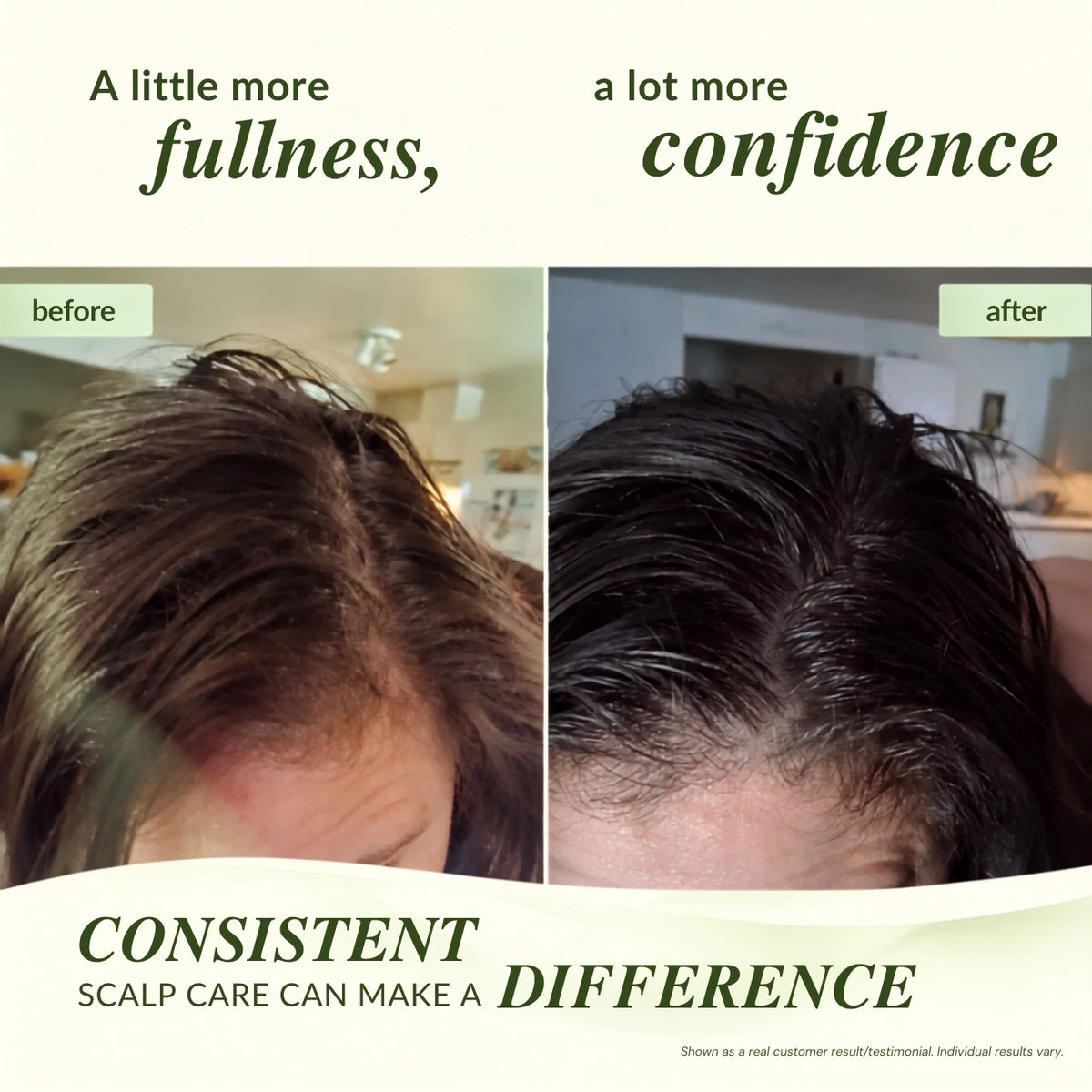 Ayurvedic Biomimetic Scalp Serum