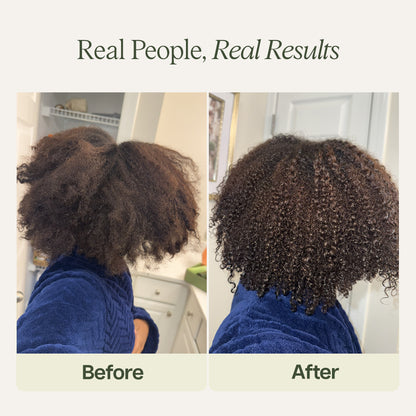 Scalp & Hair Oil | 3.4 oz